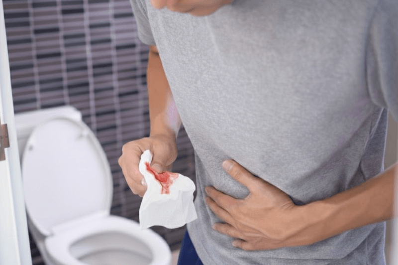 Blood in Stool: 7 Possible Causes You Should Not Ignore